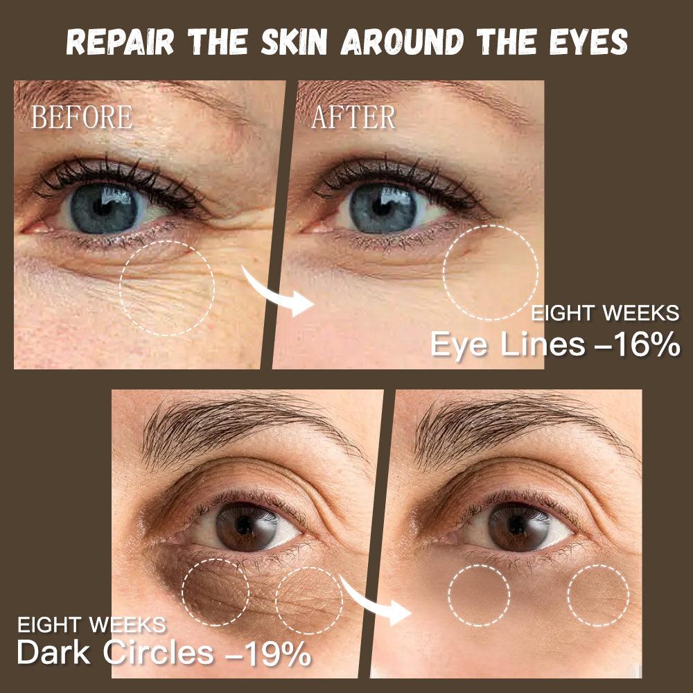 GUANJING Natural Skincare Retinol Eye Cream Vegan Organic Anti Aging Moisturizer Anti - wrinkle Skin Whitening Retinol Eye Cream - MANDOTOS
